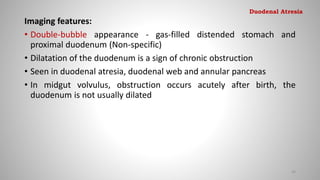 Imaging features:
• Double-bubble appearance - gas-filled distended stomach and
proximal duodenum (Non-specific)
• Dilatation of the duodenum is a sign of chronic obstruction
• Seen in duodenal atresia, duodenal web and annular pancreas
• In midgut volvulus, obstruction occurs acutely after birth, the
duodenum is not usually dilated
34
Duodenal Atresia
 