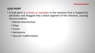 LEAD POINT
• A lead point is a lesion or variation in the intestine that is trapped by
peristalsis and dragged into a distal segment of the intestine, causing
intussusception.
• Meckel diverticulum
• Polyp
• Tumor
• Hematoma
• Vascular malformation
83
Intussusception
 