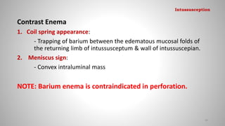 Contrast Enema
1. Coil spring appearance:
- Trapping of barium between the edematous mucosal folds of
the returning limb of intussusceptum & wall of intussuscepian.
2. Meniscus sign:
- Convex intraluminal mass
NOTE: Barium enema is contraindicated in perforation.
94
Intussusception
 