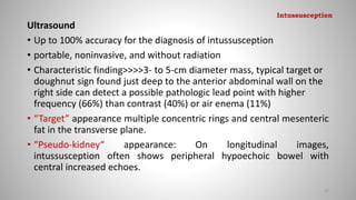 Ultrasound
• Up to 100% accuracy for the diagnosis of intussusception
• portable, noninvasive, and without radiation
• Characteristic finding>>>>3- to 5-cm diameter mass, typical target or
doughnut sign found just deep to the anterior abdominal wall on the
right side can detect a possible pathologic lead point with higher
frequency (66%) than contrast (40%) or air enema (11%)
• “Target” appearance multiple concentric rings and central mesenteric
fat in the transverse plane.
• “Pseudo-kidney“ appearance: On longitudinal images,
intussusception often shows peripheral hypoechoic bowel with
central increased echoes.
97
Intussusception
 