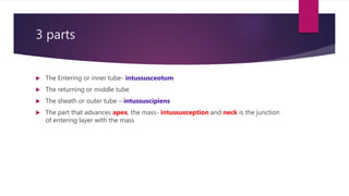 3 parts
 The Entering or inner tube- intussusceotum
 The returning or middle tube
 The sheath or outer tube – intussuscipiens
 The part that advances apex, the mass- intussusception and neck is the junction
of entering layer with the mass
 