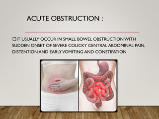 ACUTE OBSTRUCTION :
IT USUALLY OCCUR IN SMALL BOWEL OBSTRUCTION WITH
SUDDEN ONSET OF SEVERE COLICKY CENTRAL ABDOMINAL PAIN,
DISTENTION AND EARLYVOMITING AND CONSTIPATION.
 