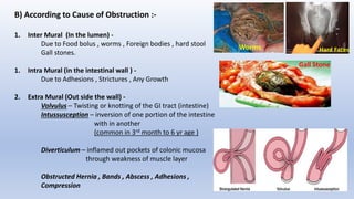 B) According to Cause of Obstruction :-
1. Inter Mural (In the lumen) -
Due to Food bolus , worms , Foreign bodies , hard stool
Gall stones.
1. Intra Mural (in the intestinal wall ) -
Due to Adhesions , Strictures , Any Growth
2. Extra Mural (Out side the wall) -
Volvulus – Twisting or knotting of the GI tract (intestine)
Intussusception – inversion of one portion of the intestine
with in another
(common in 3rd month to 6 yr age )
Diverticulum – inflamed out pockets of colonic mucosa
through weakness of muscle layer
Obstructed Hernia , Bands , Abscess , Adhesions ,
Compression
Worms Hard Faces
Gall Stone
 
