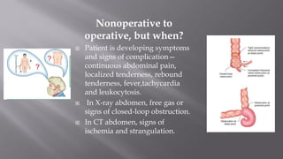 Nonoperative to
operative, but when?
 Patient is developing symptoms
and signs of complication—
continuous abdominal pain,
localized tenderness, rebound
tenderness, fever,tachycardia
and leukocytosis.
 In X-ray abdomen, free gas or
signs of closed-loop obstruction.
 In CT abdomen, signs of
ischemia and strangulation.
 