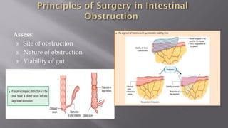 Assess:
 Site of obstruction
 Nature of obstruction
 Viability of gut
 