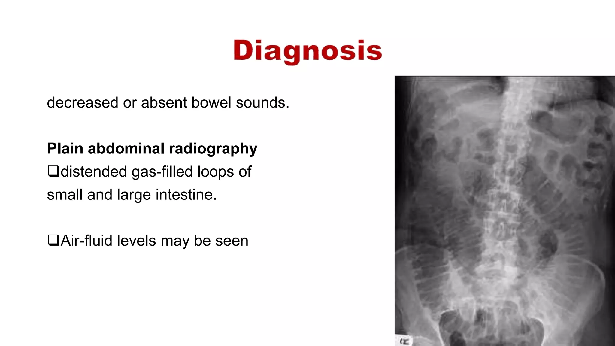 decreased or absent bowel sounds.
Plain abdominal radiography
distended gas-filled loops of
small and large intestine.
Air-fluid levels may be seen
 