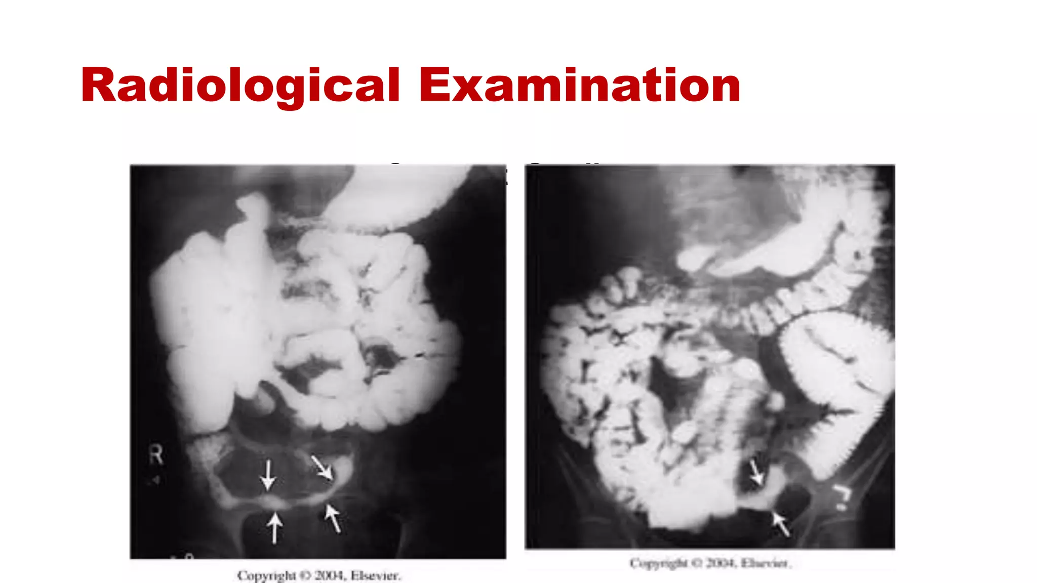 Radiological Examination
Contrast Studies:
 