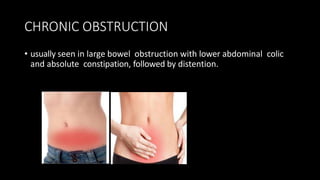 CHRONIC OBSTRUCTION
• usually seen in large bowel obstruction with lower abdominal colic
and absolute constipation, followed by distention.
 