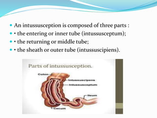 Intestinal obstruction | PPTX