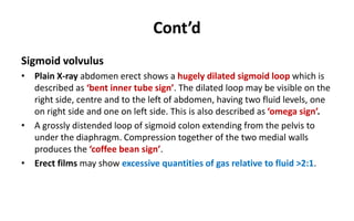 Cont’d
Sigmoid volvulus
• Plain X-ray abdomen erect shows a hugely dilated sigmoid loop which is
described as ‘bent inner tube sign’. The dilated loop may be visible on the
right side, centre and to the left of abdomen, having two fluid levels, one
on right side and one on left side. This is also described as ‘omega sign’.
• A grossly distended loop of sigmoid colon extending from the pelvis to
under the diaphragm. Compression together of the two medial walls
produces the ‘coffee bean sign’.
• Erect films may show excessive quantities of gas relative to fluid >2:1.
 