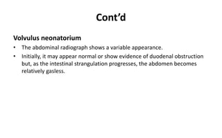 Cont’d
Volvulus neonatorium
• The abdominal radiograph shows a variable appearance.
• Initially, it may appear normal or show evidence of duodenal obstruction
but, as the intestinal strangulation progresses, the abdomen becomes
relatively gasless.
 