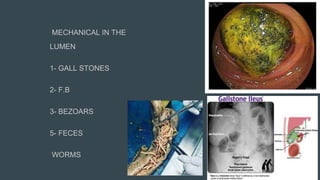 MECHANICAL IN THE
LUMEN
1- GALL STONES
2- F.B
3- BEZOARS
5- FECES
WORMS
 