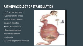 PATHOPHYSIOLOGY OF STRANGULATION
(1) Proximal segment •
Hyperperistaltic phase
•Antiperistaltic phase •
Stage of dilatation
•Fluid accumulation
•Gas accumulation
•Increased tension
•Ischemia
(2) Distal segment Collapsed
 