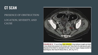 CT SCAN
PRESENCE OF OBSTRUCTION
LOCATION, SEVERITY, AND
CAUSE
 