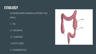 ETIOLOGY
DYNAMIC(MECHANICAL)FROM THE
WALL
1- TB
2- CROHN’S
3- TUMORS
4-STICTURE
5- CONGENITAL
 