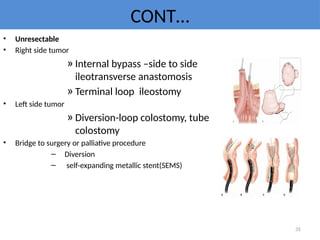 Intestinal obstruction is one of the most important part of long case ...