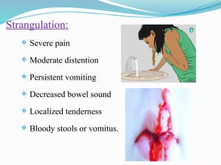 Comprehensive Overview of Intestinal Obstruction: Causes, Diagnosis ...