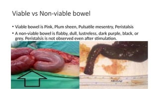 Viable vs Non-viable bowel
• Viable bowel is Pink, Plum sheen, Pulsatile mesentry, Peristalsis
• A non-viable bowel is flabby, dull, lustreless, dark purple, black, or
grey. Peristalsis is not observed even after stimulation.
 