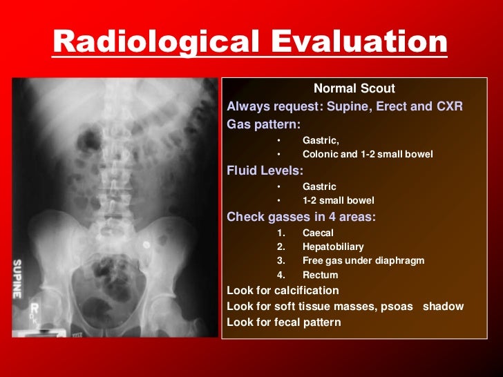 Intestinal obstruction2