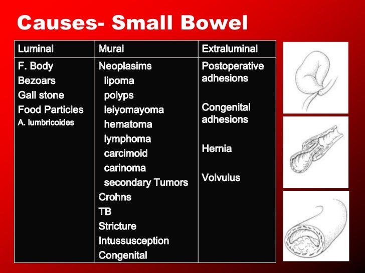 Intestinal obstruction2