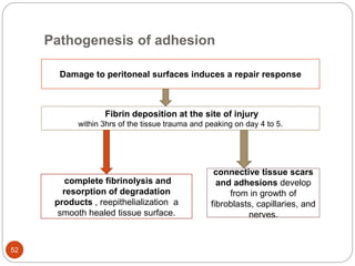 Intestinal Obstruction in Adults 2023 final-1.pptx
