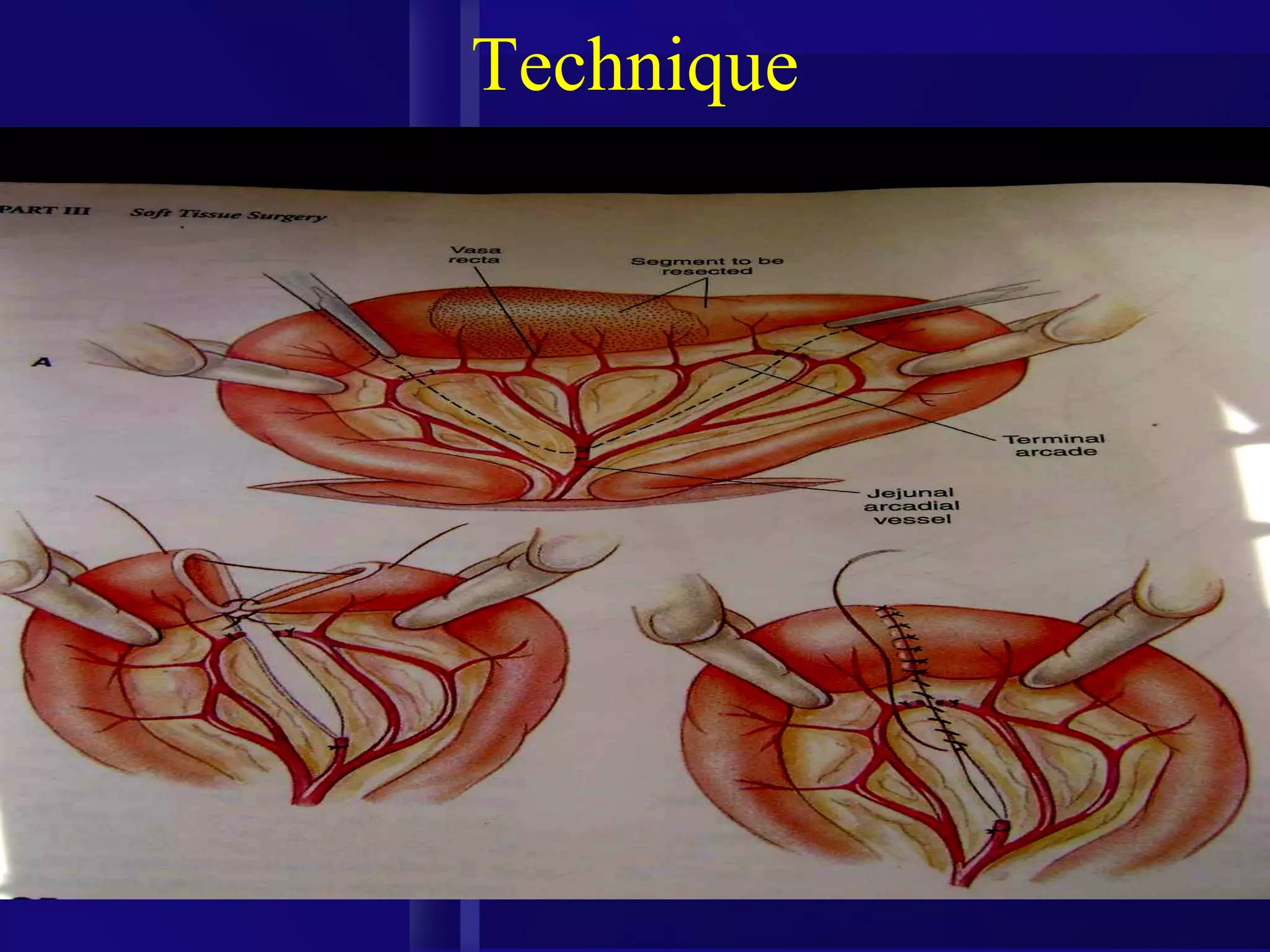Intestinal obstruction in small animals | PPT - Intestinal Obstruction In Animals
