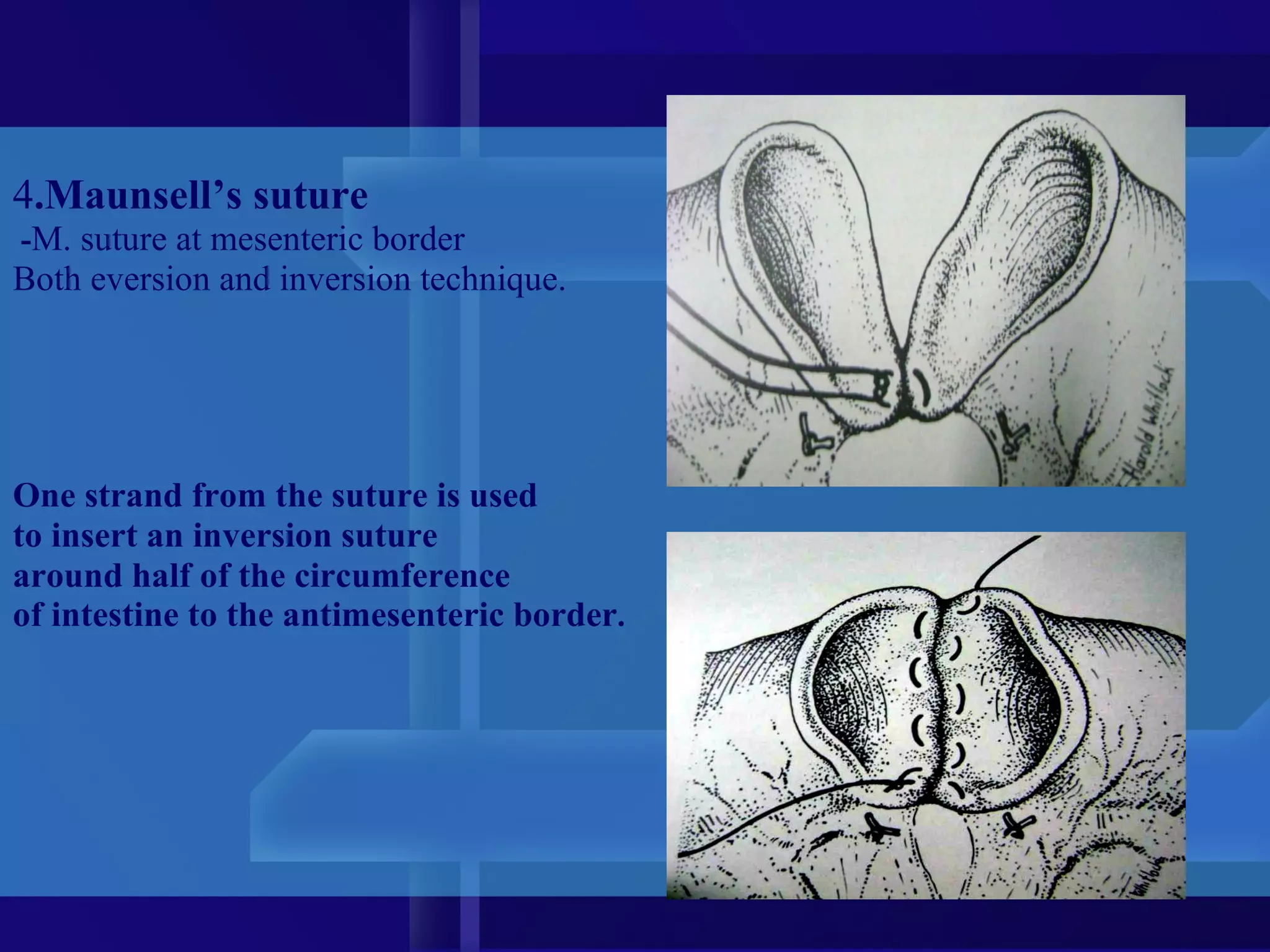 Inversion Intestine Intestinal obstruction in small animals | PPT