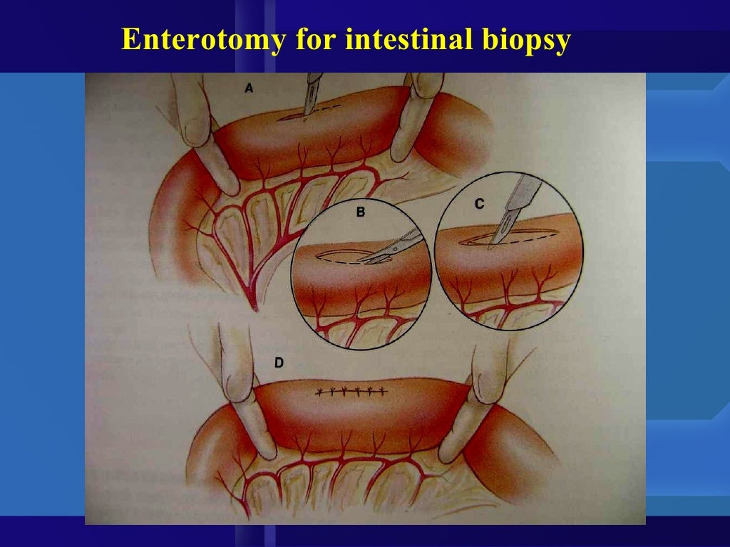 Intestinal obstruction in small animals
