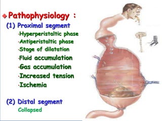  Pathophysiology :
(1) Proximal segment
•Hyperperistaltic phase
•Antiperistaltic phase
•Stage of dilatation
•Fluid accumulation
•Gas accumulation
•Increased tension
•Ischemia
(2) Distal segment
Collapsed
 
