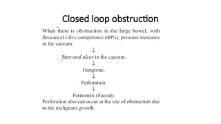 Closed loop obstruction
 