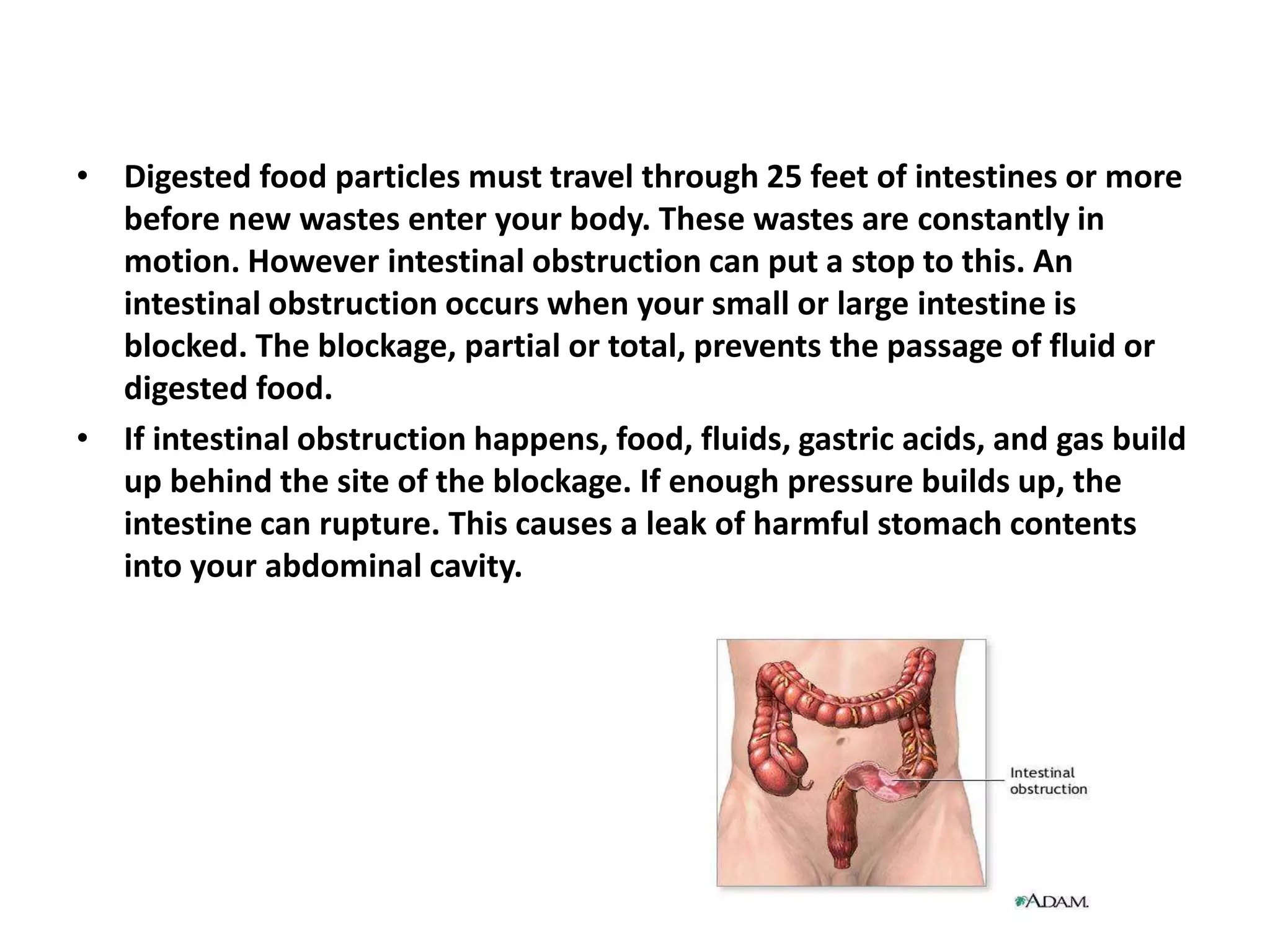 Photo inspiration: Gallery Detail: Intestinal Obstruction Ppt Pptx