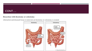 INTESTINAL OBSTRUCTION ppt [Autosaved].pptx