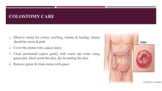 INTESTINAL OBSTRUCTION ppt [Autosaved].pptx