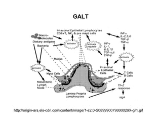 GALT 
http://origin-ars.els-cdn.com/content/image/1-s2.0-S089990079800029X-gr1.gif 
 