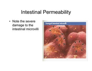 Intestinal Permeability 
• Note the severe 
damage to the 
intestinal microvilli 
 