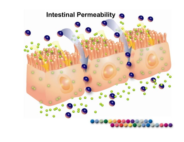 LEAKY GUT Intestinal permeability | PDF