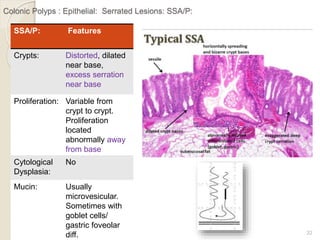 Intestinal polyps | PPTX