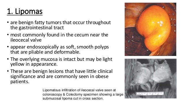 Copd Oxygen Diagnosis - Hirup a