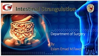 Department of Surgery
By:
Eslam Emad M.Fawzy
 