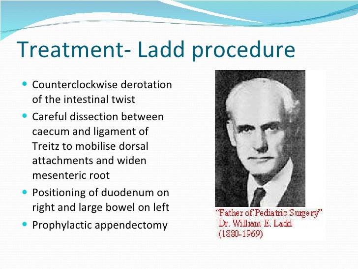 19+ Ligament Of Treitz Surgery Images