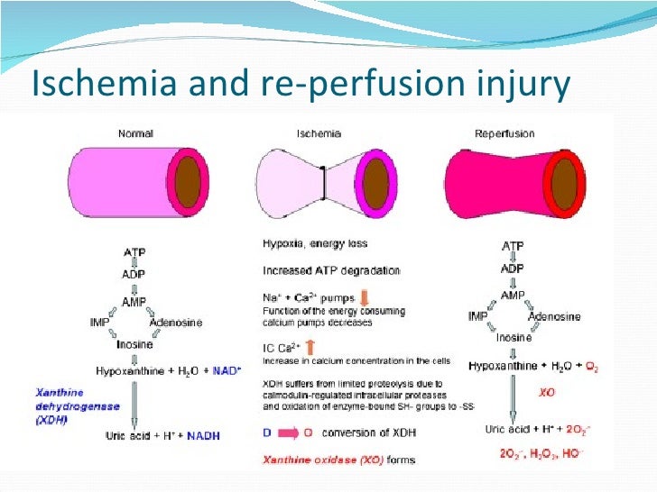 Mesenteric torsion pathology and management