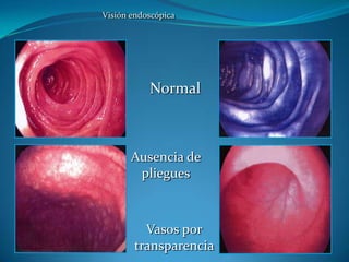  Osteopenia/Osteoporosis