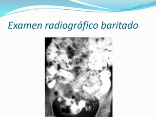 Examen radiográfico baritado