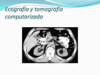 Ecografía y tomografía computarizada