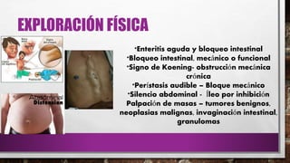 Irritación peritoneal –
hiperestesia cutánea, contractura
muscular, dolor a la
descompresión
Perforación- datos de
neumope...