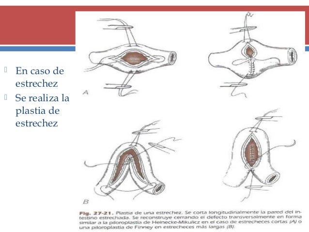 Duele el sacro los riñones el tratamiento