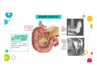 4
Ampolla duodenal
Los 2 cm iniciales de
la porción superior
del duodeno,
inmediatamente
distales al píloro,
tienen un mesenterio y
son móviles.
 
