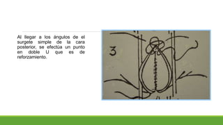 Al llegar a los ángulos de el
surgete simple de la cara
posterior, se efectúa un punto
en doble U que es de
reforzamiento.
 