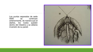 Los puntos separados de seda
0000 se continúan
anteriormente, de manera que al
atarlos, los nudos quedan
dentro del intestino y se obtiene
inversión de su pared.
 