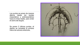 Los puntos se ponen de manera
alterna desde los bordes
mesentérico y antimesentérico
hacia la línea media, para evitar
el cierre del ángulo.
Se ponen 2 últimos puntos, al
atarlos se completa la primera
hilera de suturas anteriores.
 